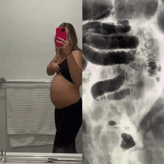 Breaking the bloat and backup cycle